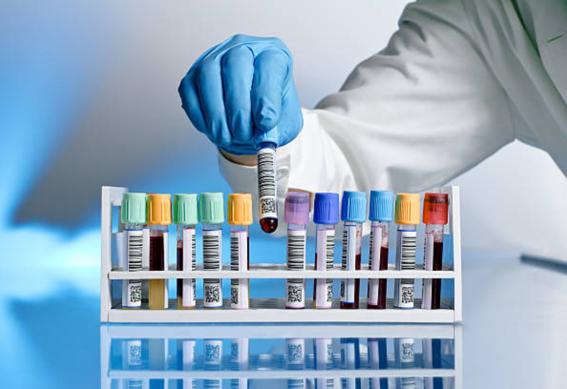 Mastère avancé en Hématologie Clinique